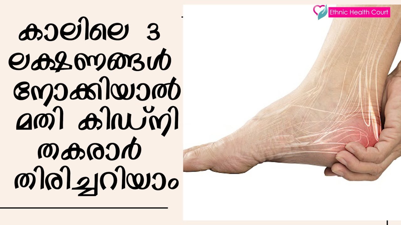കിഡ്‌നി രോഗം കാലിൽ കാണുന്ന 3 ലക്ഷണങ്ങൾ | Kidney Disease | Ethnic Health Court