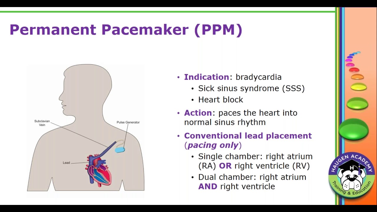 HCGTV: Webinar - Pacemaker and Defibrillator Relationship Status