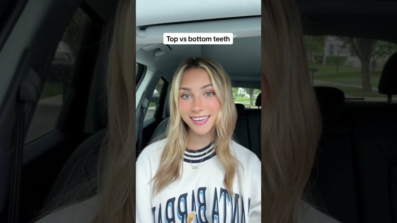 TOP teeth talker vs BOTTOM teeth talker - which one are you? #shorts