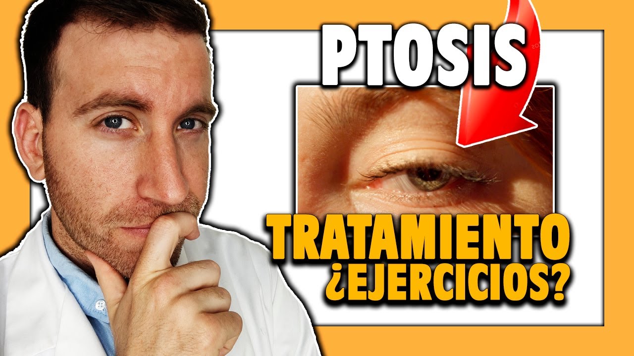🟨 ¿Cómo CURAR la PTOSIS PALPEBRAL o párpado caído?