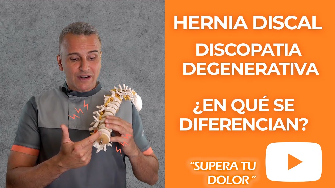 Hernia Discal vs Discopatía: ¿Cuál es la Diferencia?