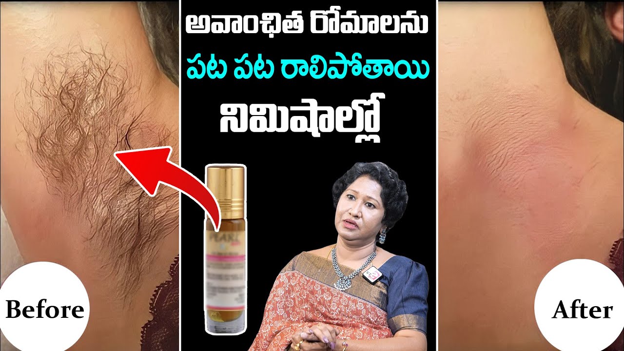 నేనే స్యయంగా వాడి చెప్తున్నా అవాంఛిత రోమాలు వారంలో తొలిగిపోతాయి | Remove Facial Hair | Arm Pearls