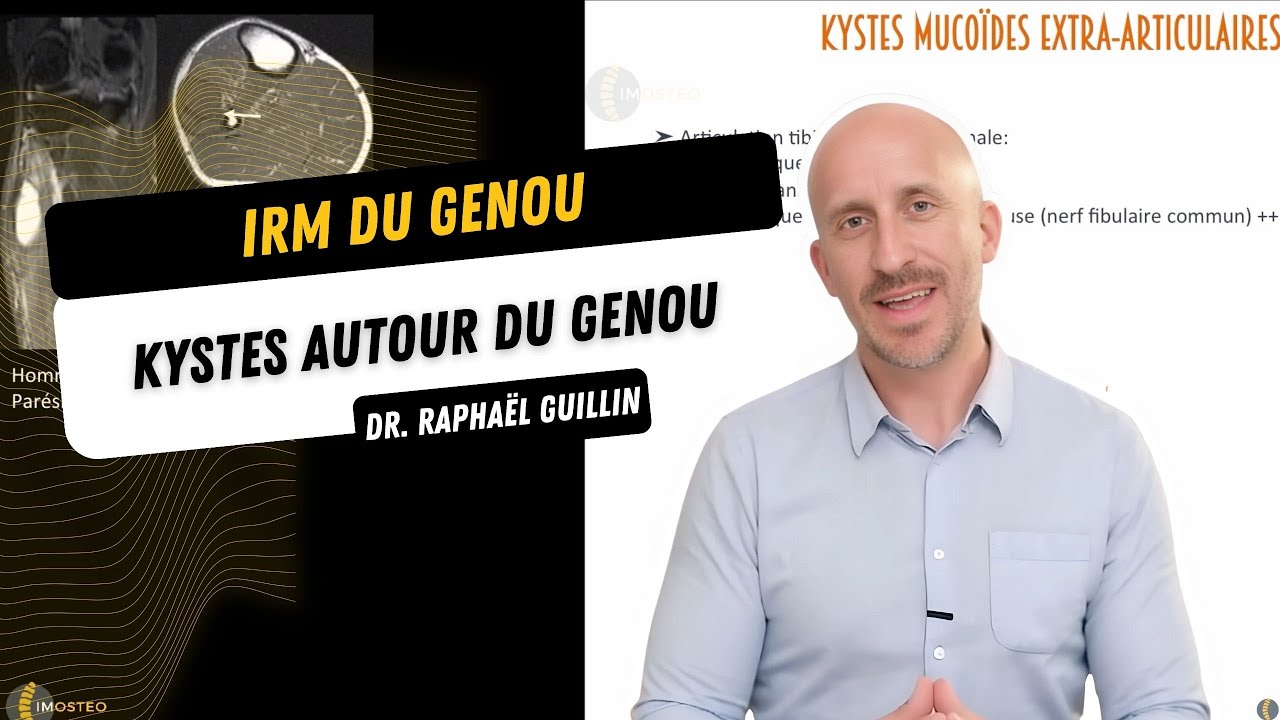 TUTORIEL IMOSTEO #16: kystes autour du genou
