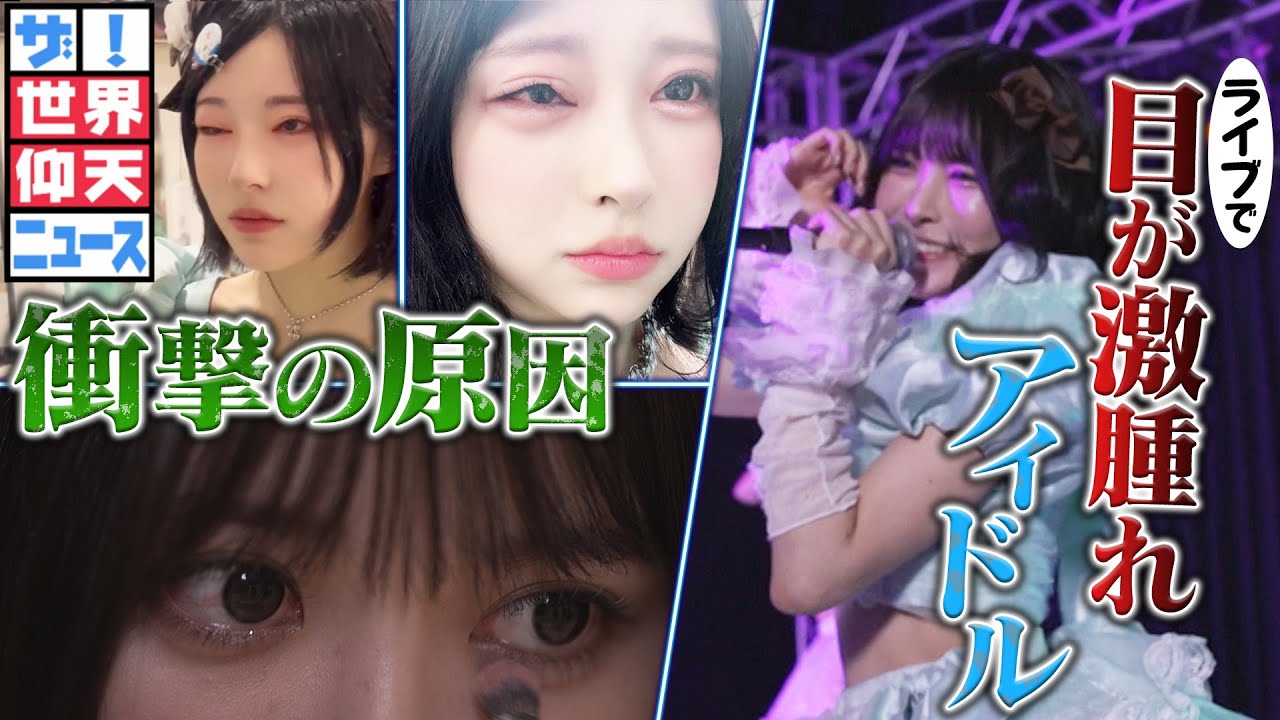 ライブを行うと目が激腫れするアイドル！衝撃の原因があった！【ザ！世界仰天ニュース】