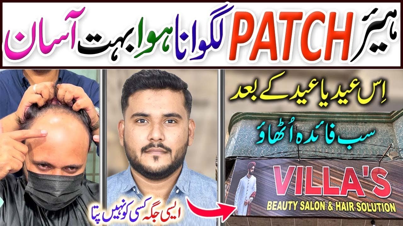 0313-2042785 Hair Patch in Pakistan | Hair Wig | Affordable Hair Extensions | Hair Cutting Design