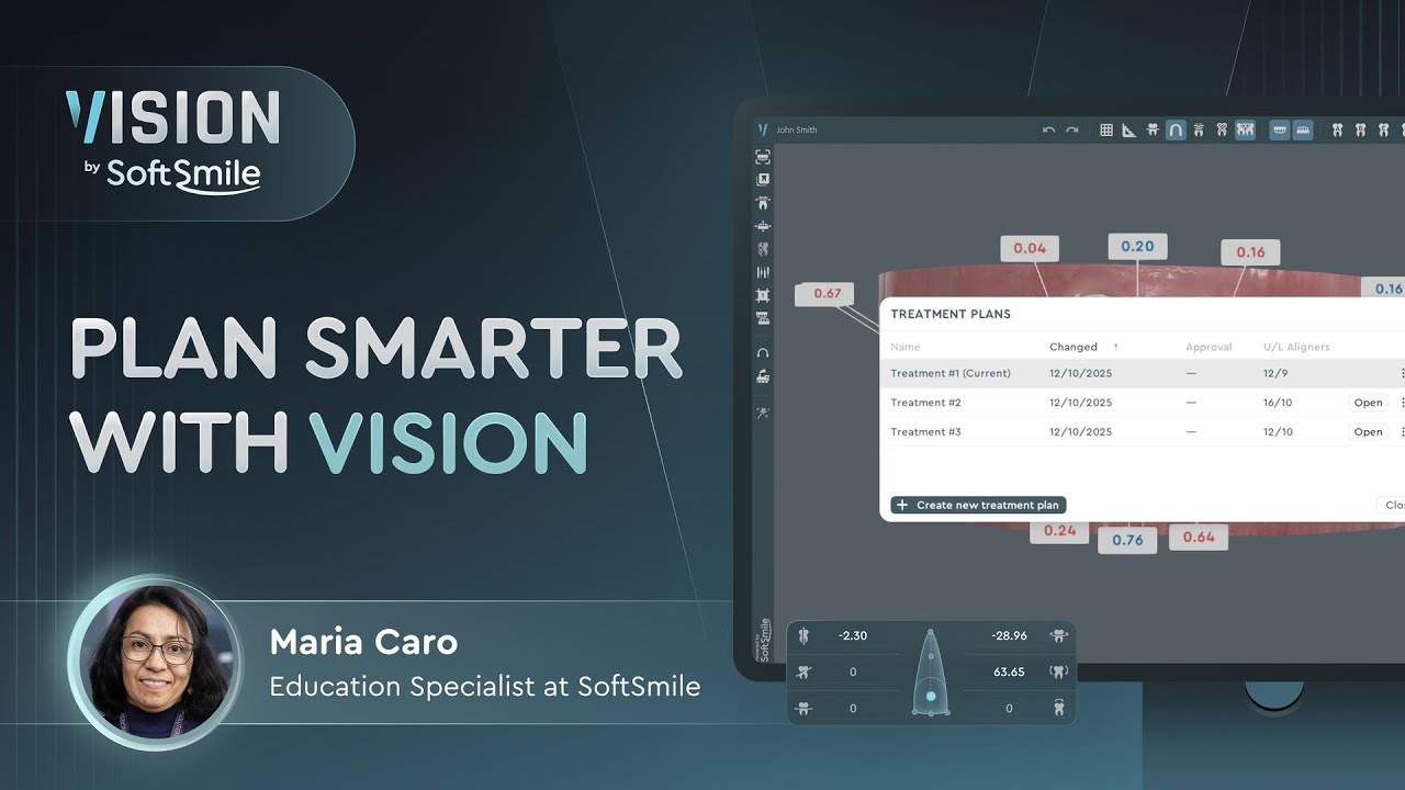 Webinar: a Walkthrough of the Latest Vision Release