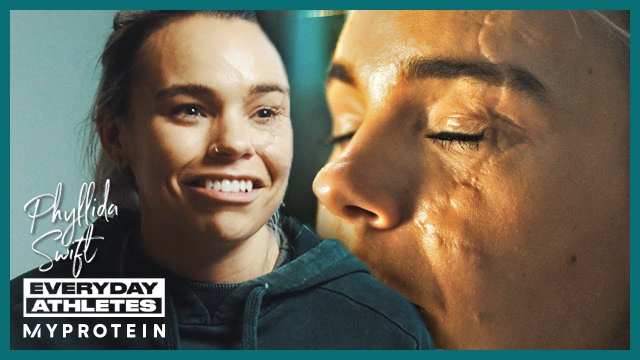 “My Scars Have Given Me A Purpose” - Athlete On Her Facial Disfigurement | Myprotein