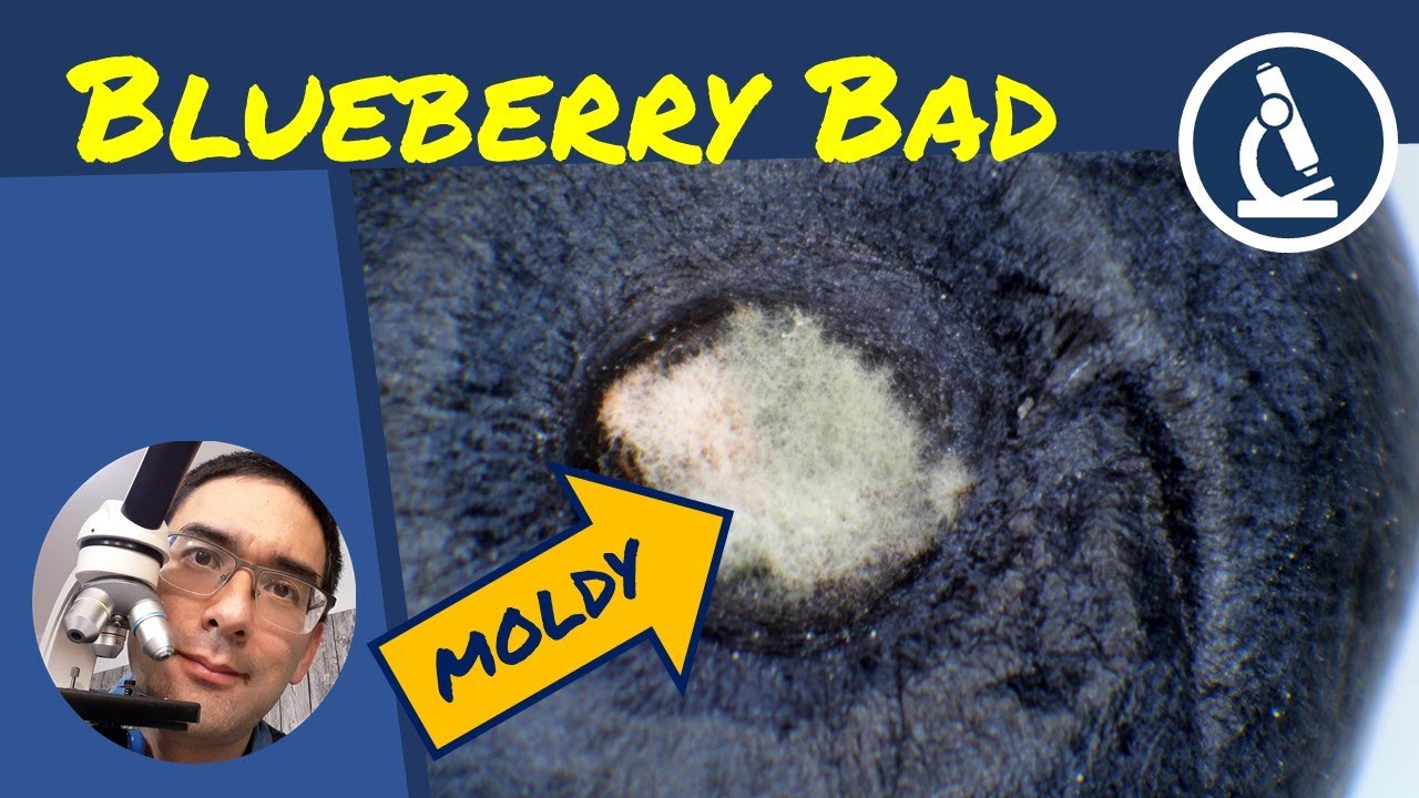 🔬 158 - Three reasons why MOLDY FOOD is bad | Mold under the microscope