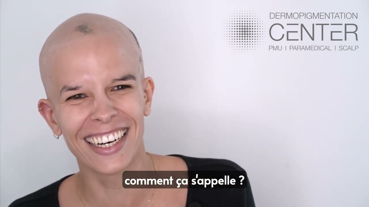 Manon partage son expérience face à son alopecie universelle