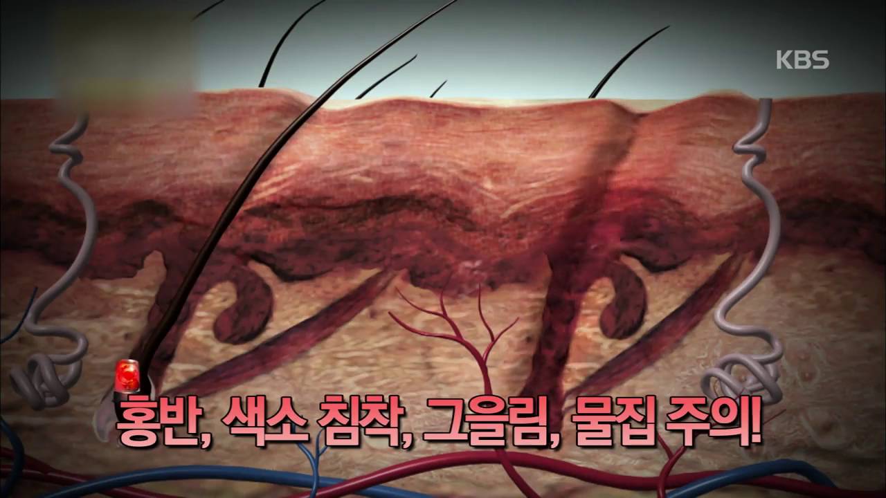 [186회] 제모, 털과 함께 수분도 사라진다
