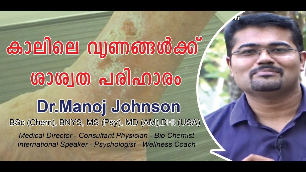 കാലിലെ വൃണങ്ങൾക്ക് ശാശ്വത പരിഹാരം | Varicose ulcer treatments by Dr Manoj Johnson