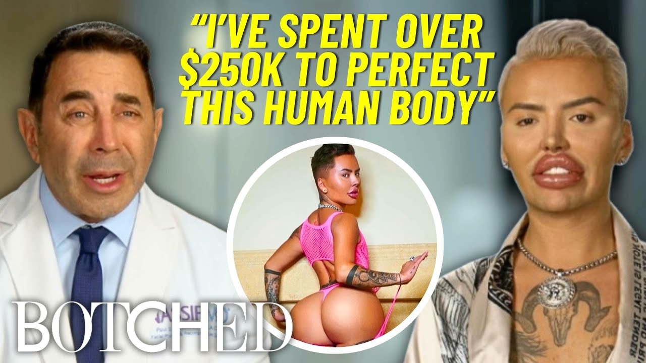 REJECTED by Botched: “BBL King” Mateo Blanco Wants A Snatched Waist & Ribs REMOVED?! | Botched | E!