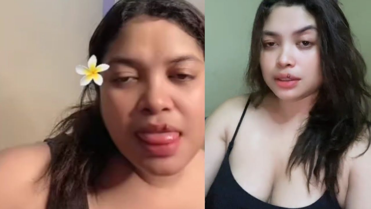 Hau Kolu An Molik iha Live