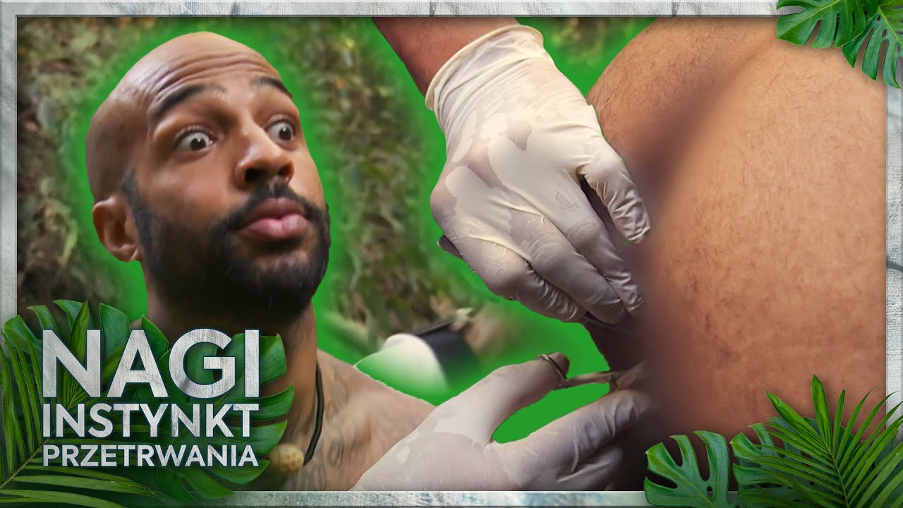 LEKARZ WYJMOWAŁ MU SZWY Z... 🍑 😳 | Nagi instynkt przetrwania