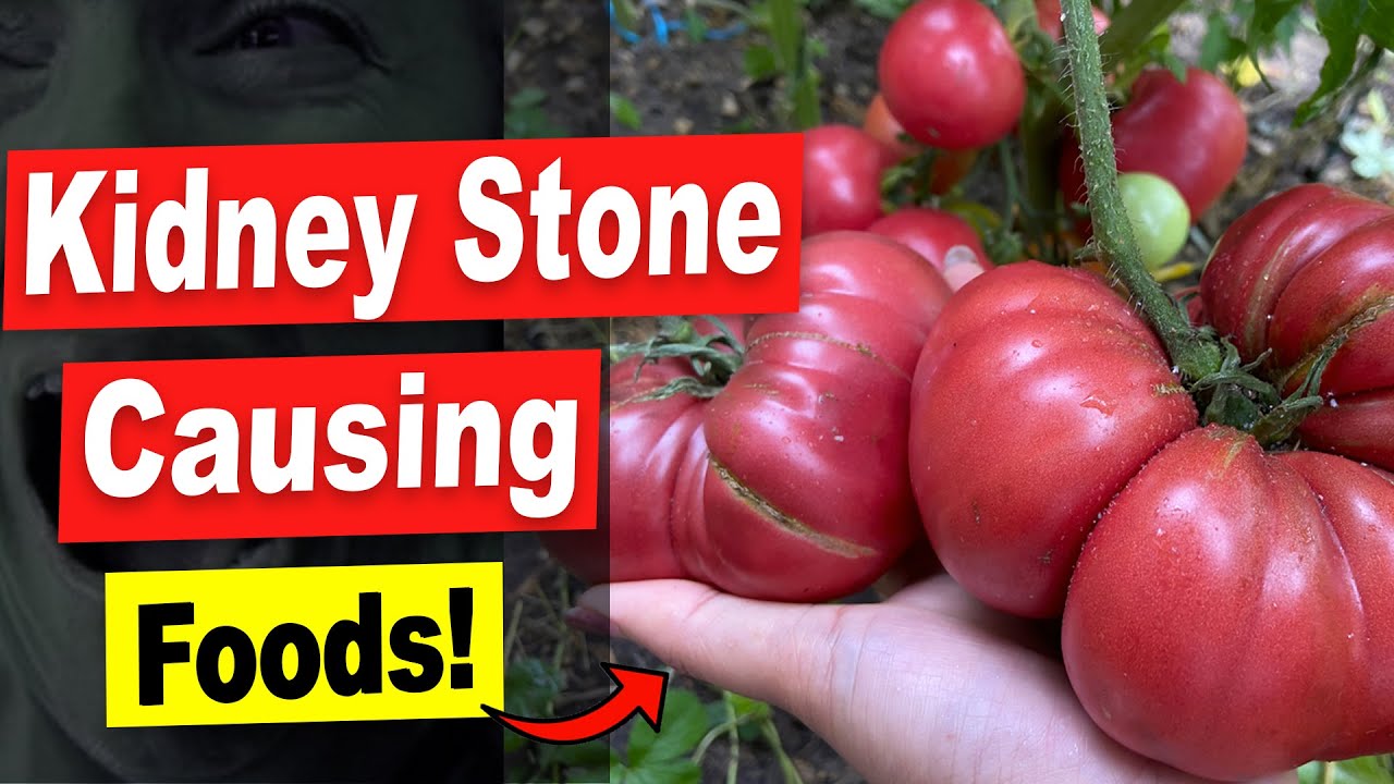 17 Foods That Turn Into Kidney Stones! Stop Eating These Kidney Stone Causing Foods!