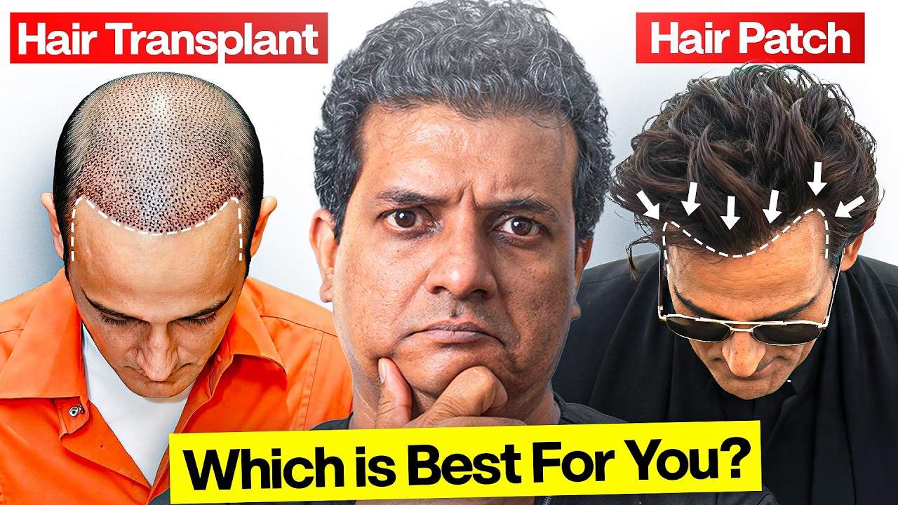 Hair Transplant vs Hair Patch: Cost, Duration, Pain Intensity | Which One is Best For You?