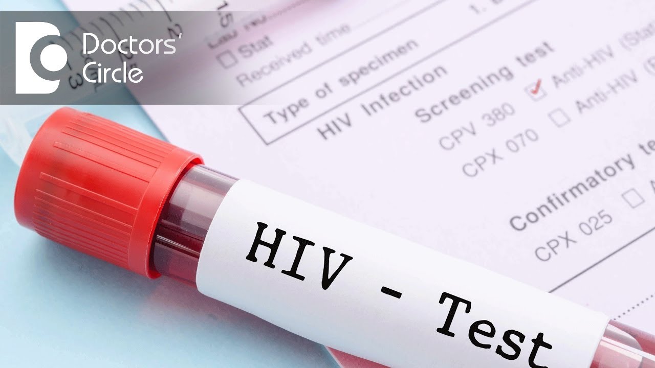 List of HIV tests & window period associated with them - Dr. Ramakrishna Prasad