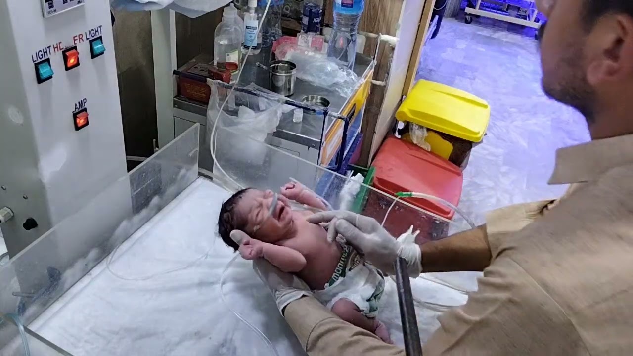 Labor Room: Newborn Baby Oxygen Support & First Assessment#ewvideo #newbornbaby#cute  