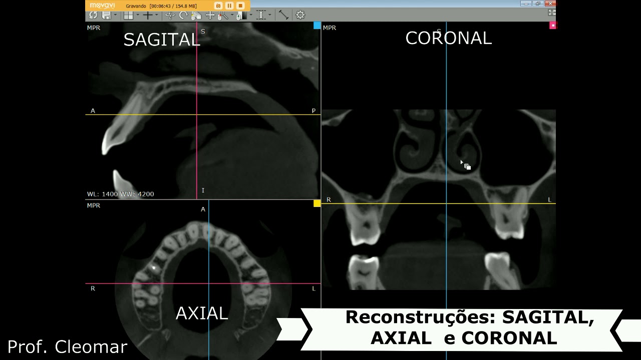RadiAnt Dicom Viewer -Tutorial para Dentistas