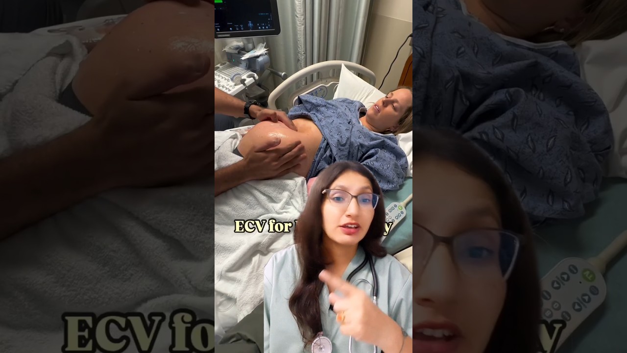 ECV( external cephalic version) #shorts #viral #medical