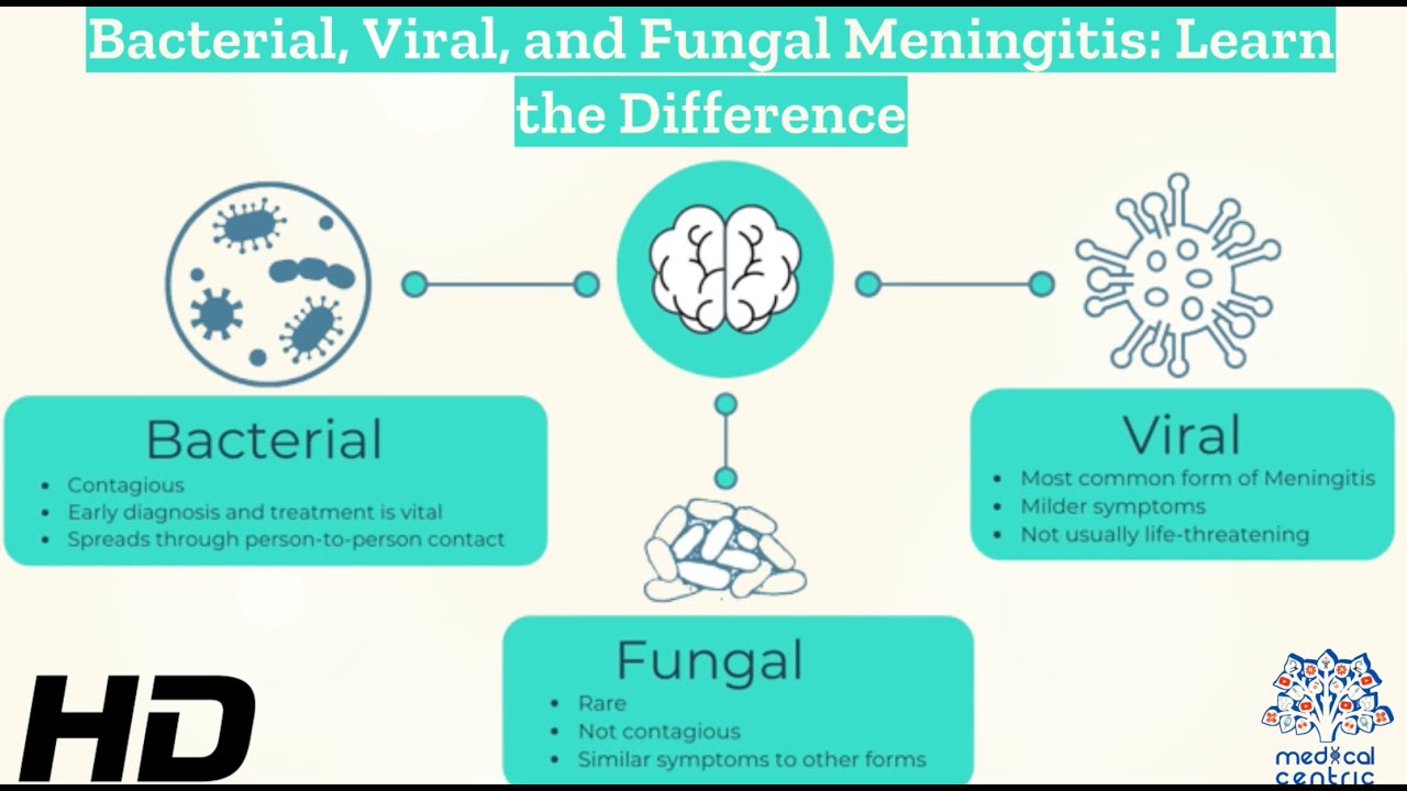 Decoding Meningitis: Understanding Bacterial, Viral, and Fungal Varieties