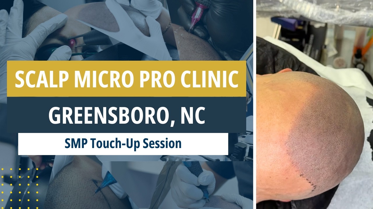 Scalp Micro Pigmentation Touch up Session