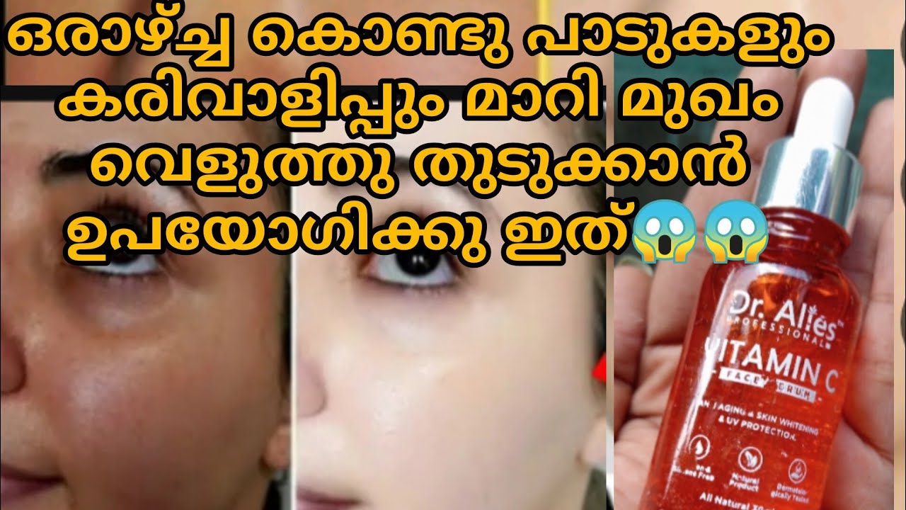 vitamin C serum ഉപയോഗിച്ച് വെളുക്കാം#viralvideos #skincareproduct #brightskin #whiteningcream #skinc