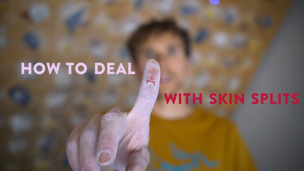 How To Take Care Of Skin Splits | Jonathan Siegrist Style