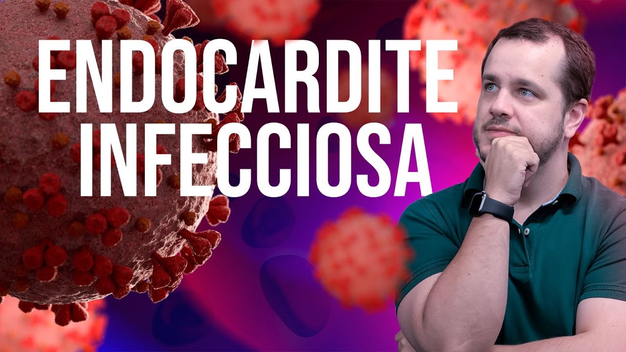 Podcast Cardiopapers: Endocardite Infecciosa