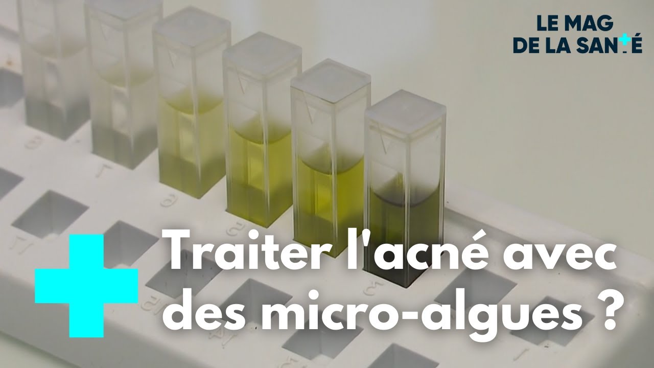 Les pouvoirs extraordinaires des micro-algues - Le Magazine de la Santé