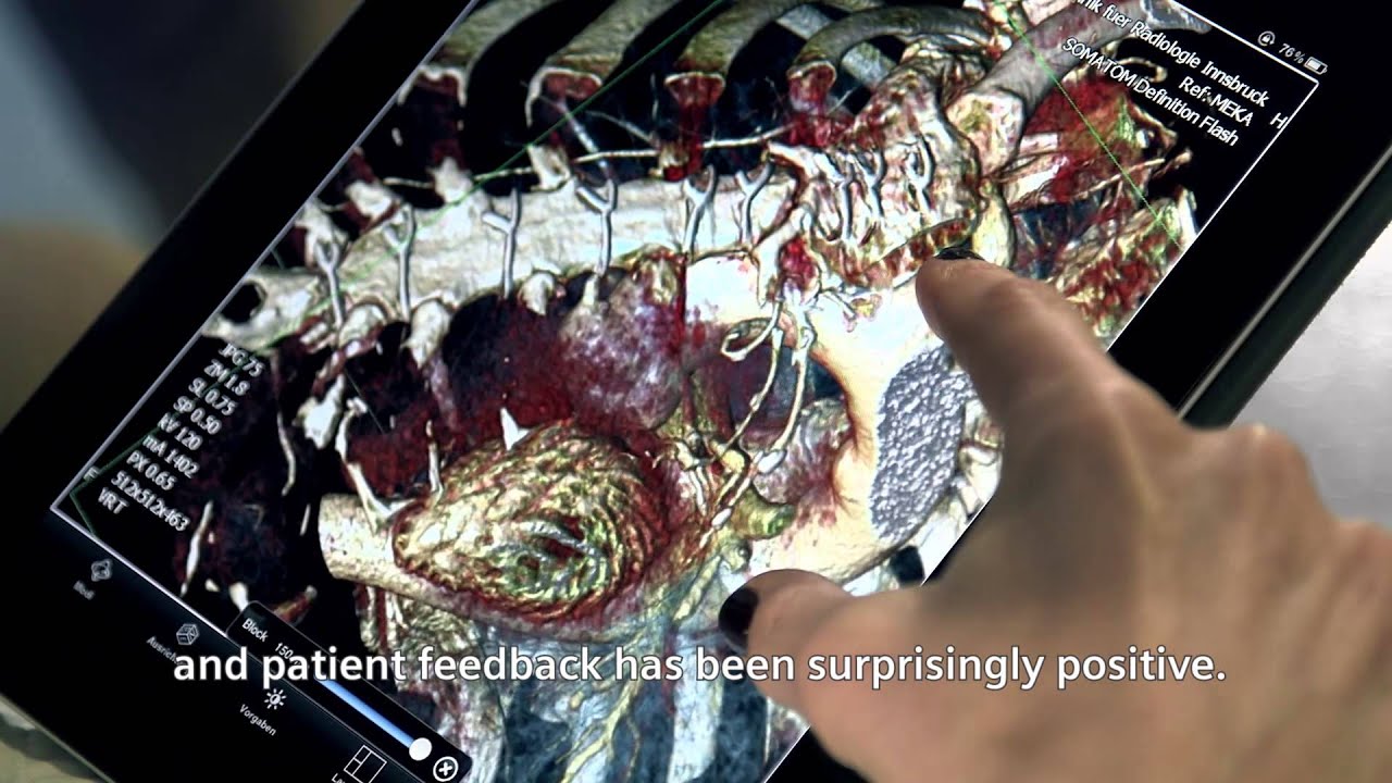 Radiology on the go with syngo.via WebViewer mobile app