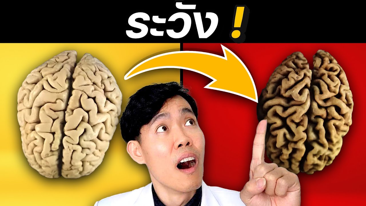 5 อาหารเร่ง อัลไซเมอร์ สมองเสื่อม (พร้อม 7 วิธีแก้ไข ) | หมอแบงค์ food doctor