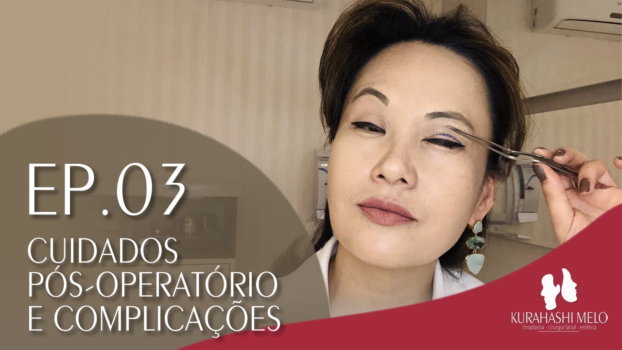 Blefaroplastia: Cuidados Pós-Operatório e Complicações  | Ep 03 Websérie Dra.Andreia Kurahashi Melo