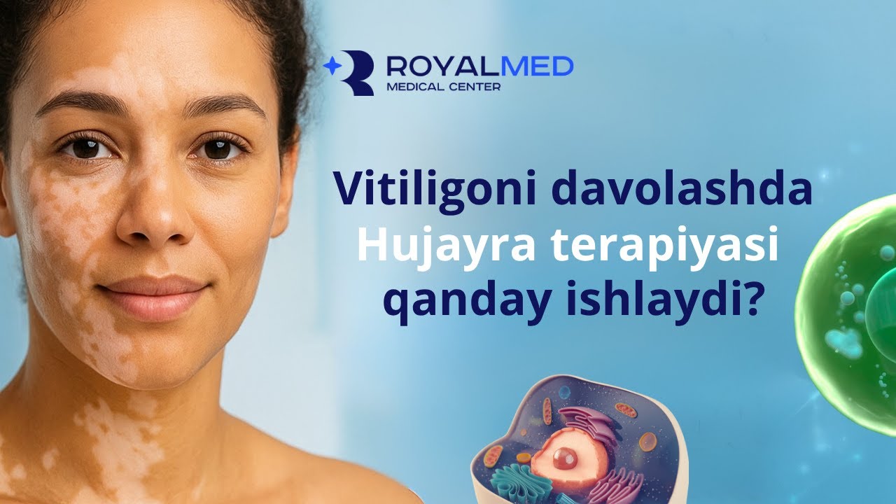Oq dog'lardan halos bo'lishni istasangiz videoni ko'ring | Oq dog'larni hujayra darajasida davolash