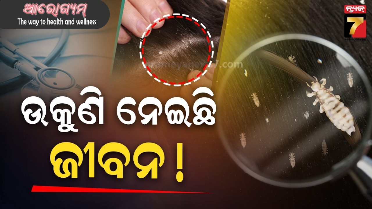 ଉଙ୍କୁଣି ହେଉଥିଲେ ସାବଧାନ, ଭୟଙ୍କର ହୋଇପାରେ ପରିଣାମ ! | Lice Death & Infection | Dr. Amit Behera | AROGYAM