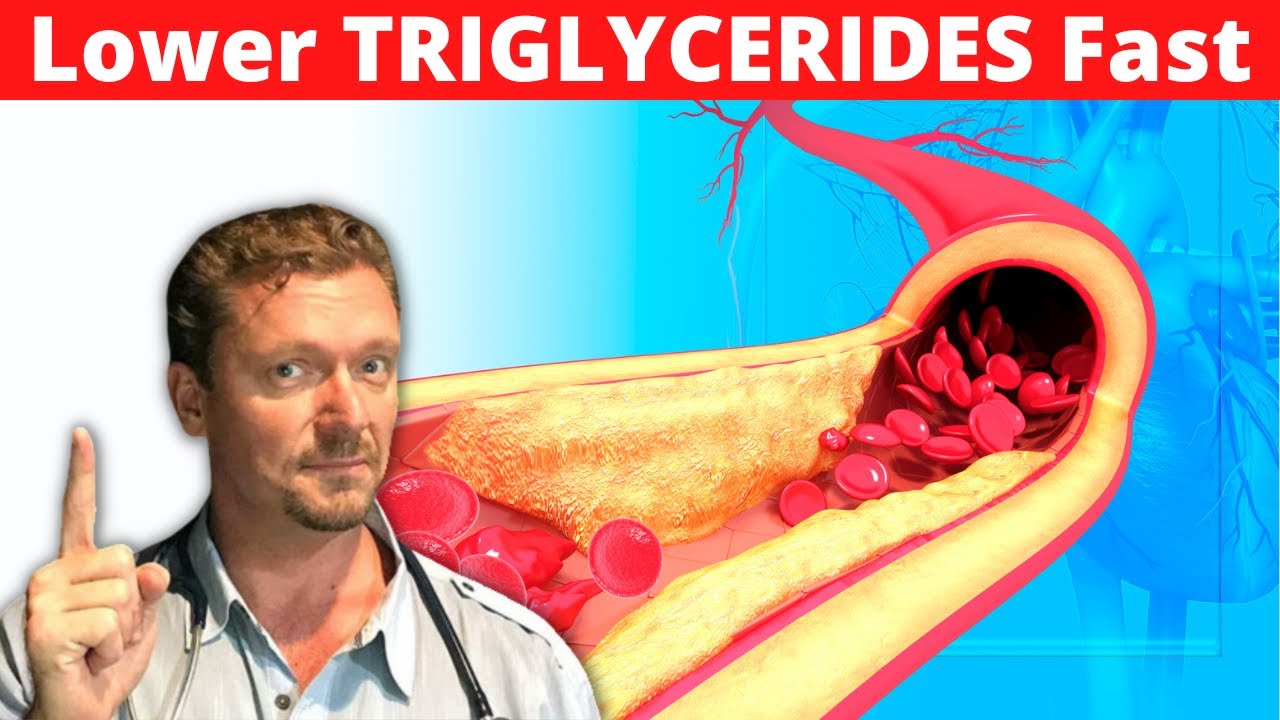 Lower TRIGLYCERIDES Quickly (Simple Steps) 2024