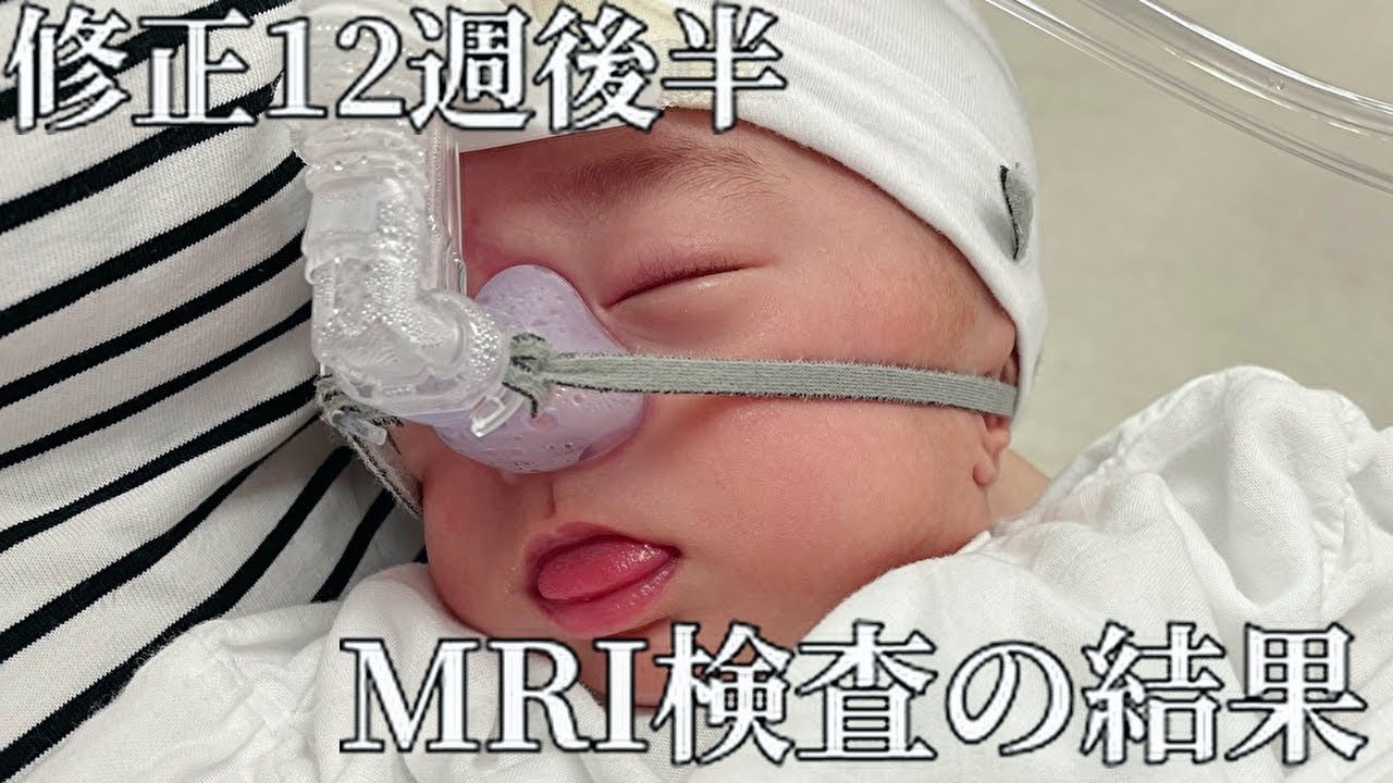 生後6ヶ月｜頭の中に出血がみられ…発達障害の説明がありました｜未熟児赤ちゃん成長記録｜早産