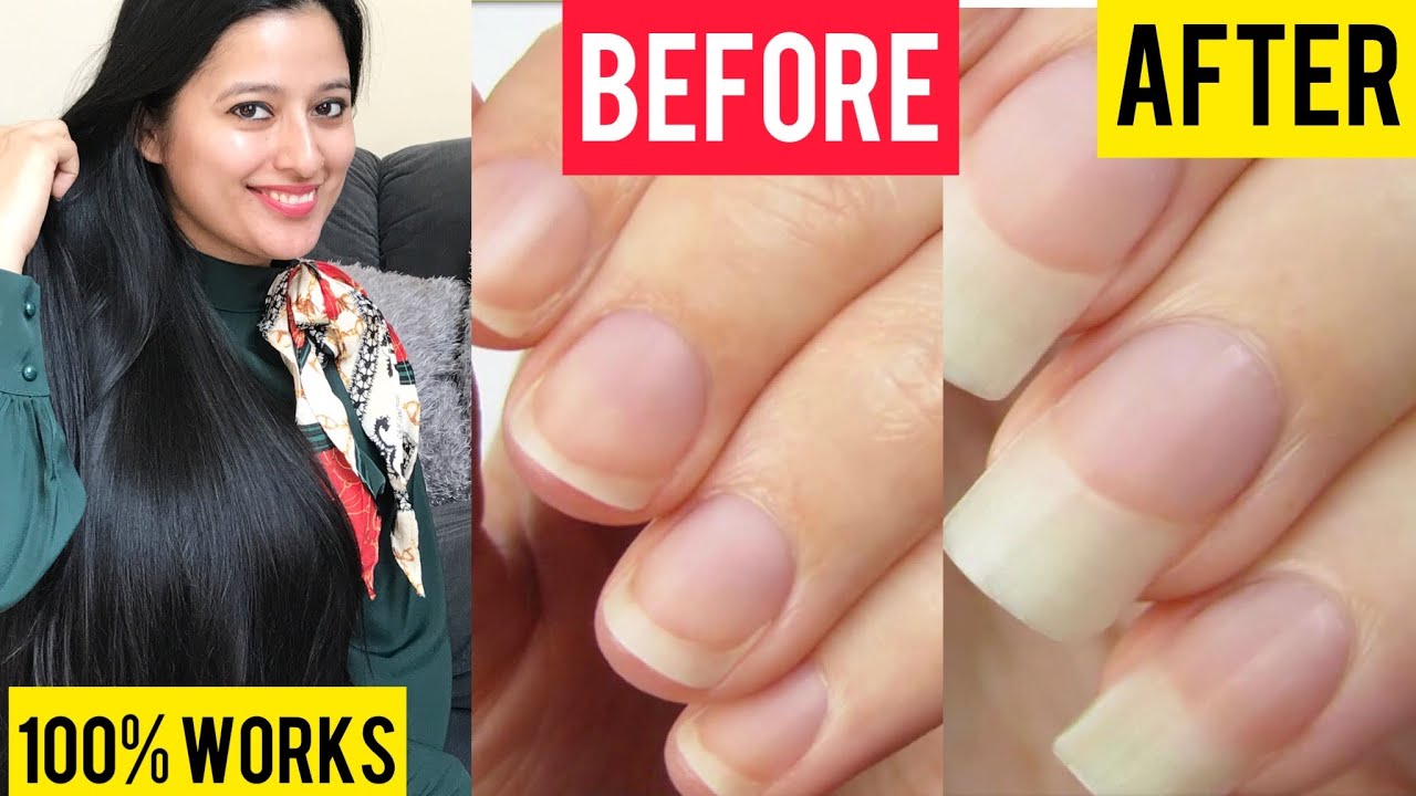 How to grow nails fast in 7 days || 5 Faster Nail Growth Mistakes and Tips || Self Care Secrets