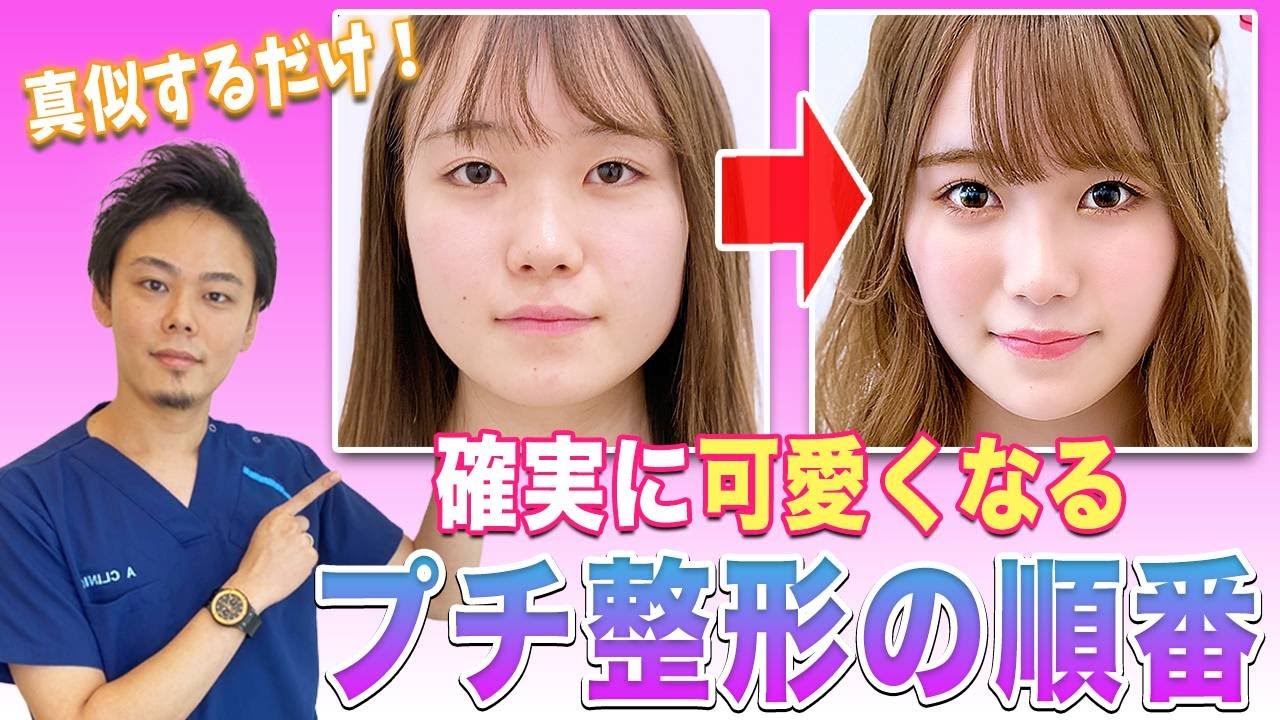 【整形順番】プチ整形 で確実に可愛くなれる整形の順番！〇〇のアリナシで可愛さ激変！？【ヒアルロン酸/ボトックス】