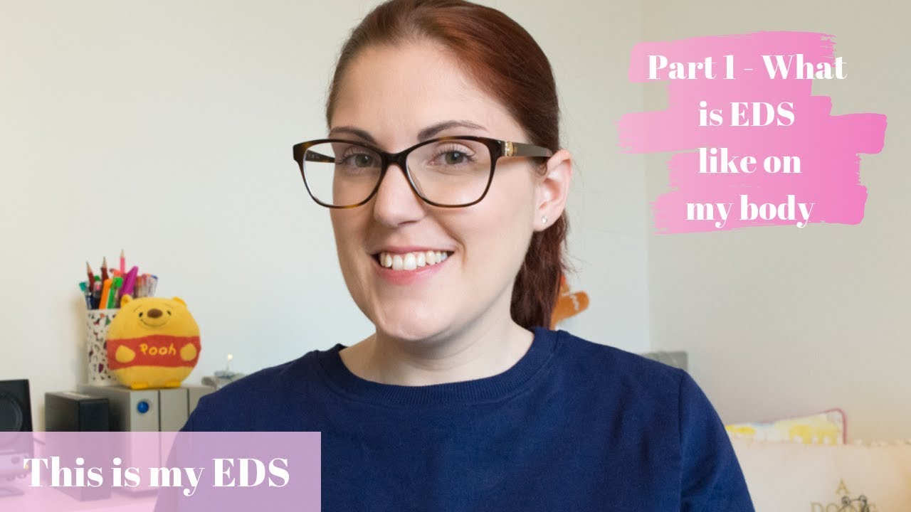 What is EDS like on MY Body? | #ThisIsMyEDS Tag