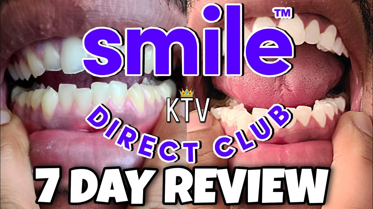 Smile Direct Club Teeth Whitening Kit 7 DAY REVIEW | KTV E:104