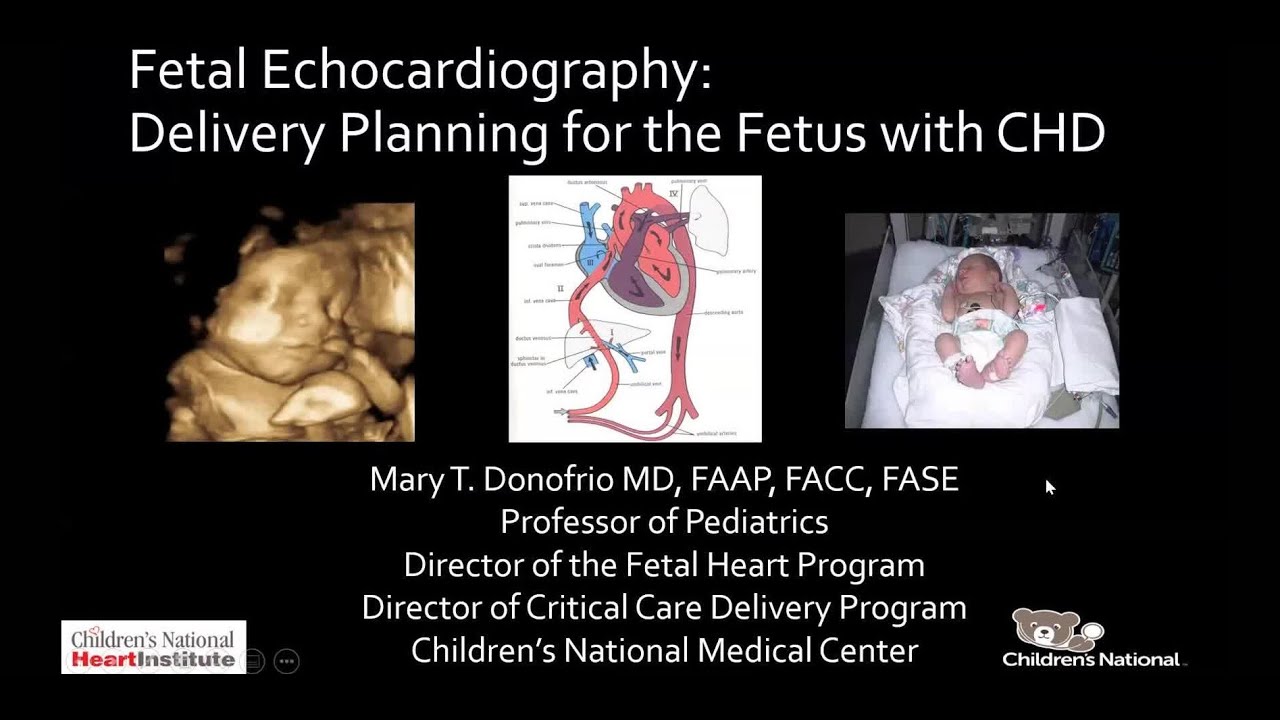 Fetal Echocardiography: Delivery Planning for the Fetus with CHD