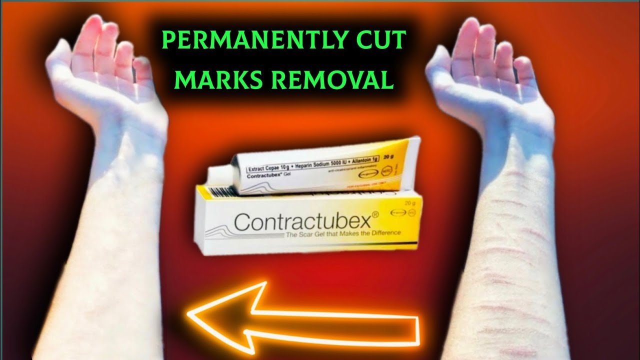 Remove cut marks and scars with contractubex gel | permanently