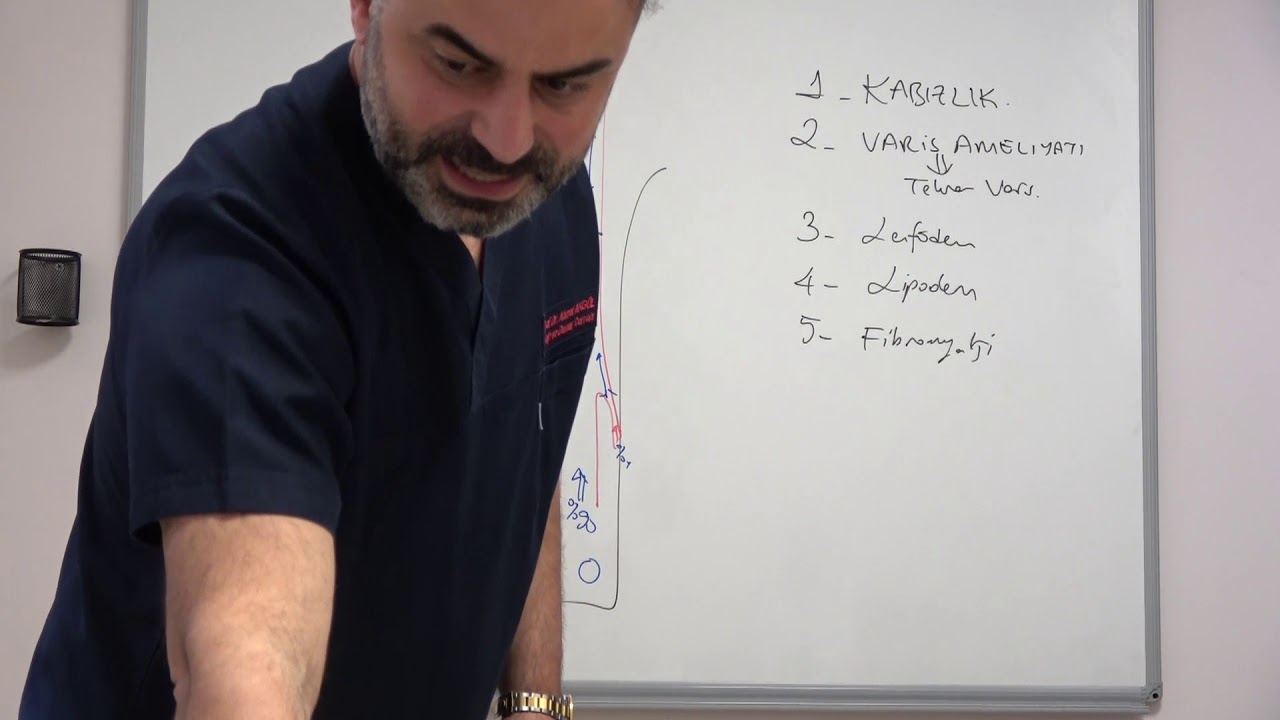 Varis tedavisi sonunda varisler TEKRAR oluşuyorsa tedavi nasıl olmalı - Prof. Dr. Ahmet AKGÜL