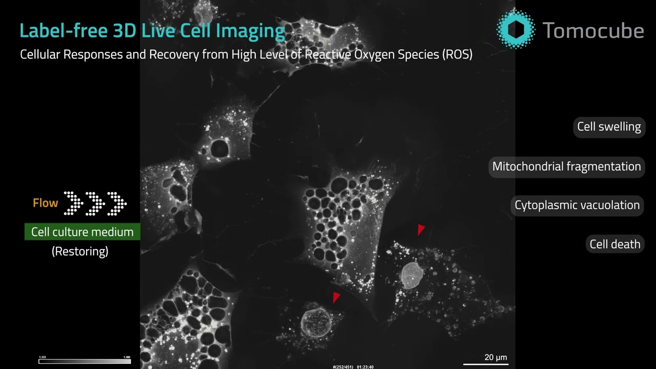 Cancer cells' response to reactive oxygen species, taken label-free by Holotomography system
