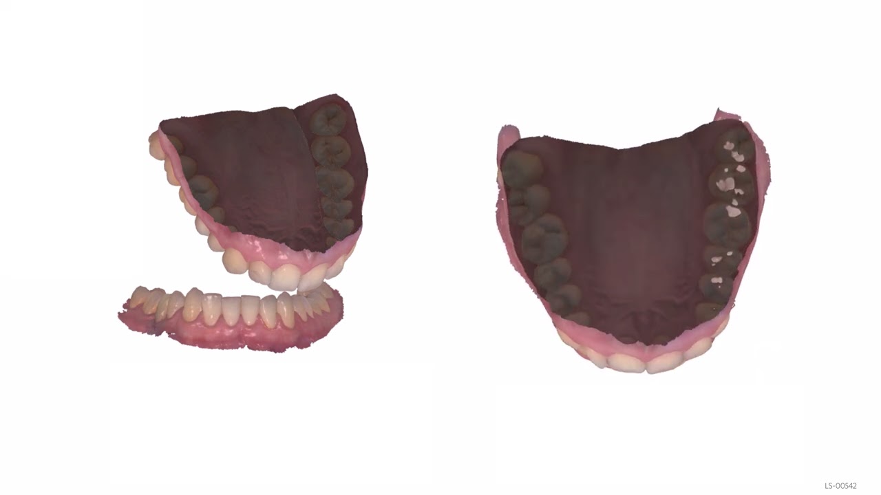 How to Use Bite Management Tools in 3Shape Dental System