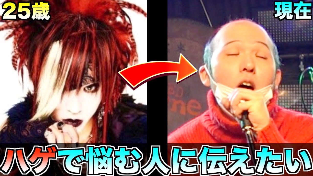 【ハゲ回】世界一ポジティブな元V系ハゲ！女性に●●と言われてハゲを克服！！