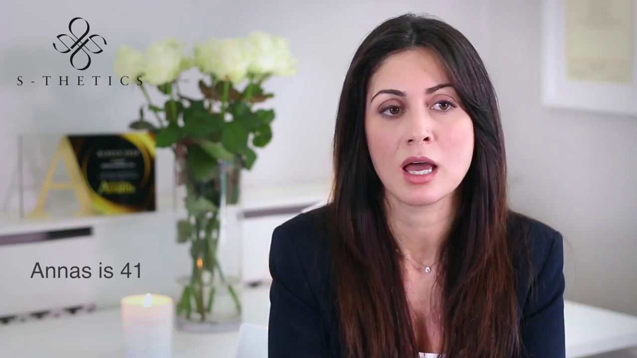 Patient Success Story   Endymed skin tightening treatments at S Thetics Clinic