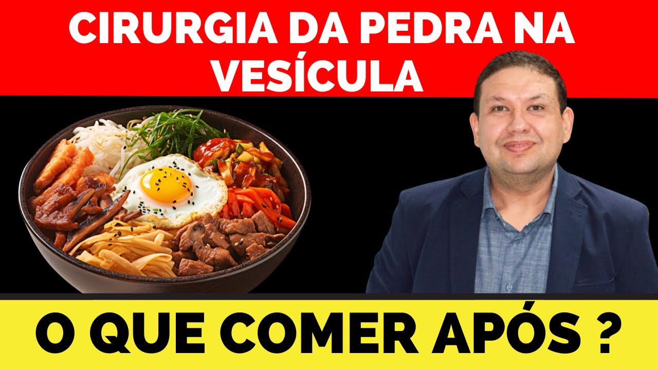 O que comer após a CIRURGIA DE PEDRA NA VESÍCULA ?