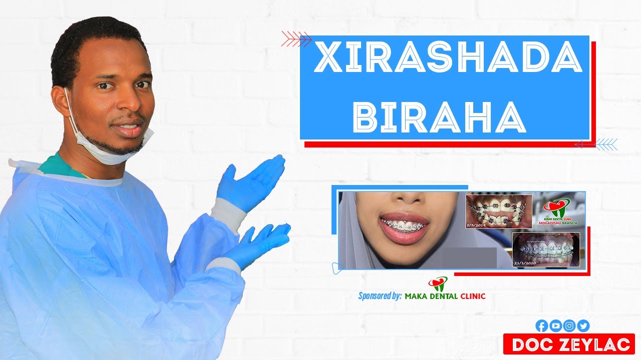 Xirashada Biraha marka ugu horeyso maxaa dhacaya?